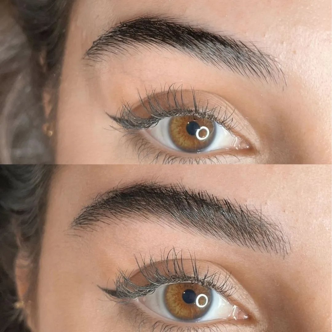 Recuperación de Cejas