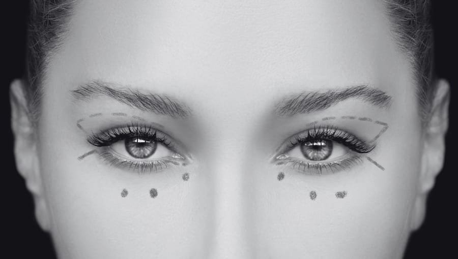 ¡Rejuvenece Tu Mirada: Expertos en Blefaroplastia para Eliminar Bolsas y Mejorar Párpados!