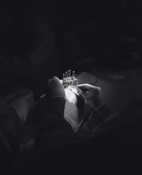 12 Dr. Emiliano Alvarez - Experto en rinoplastia ultrasónica en Barcelona.