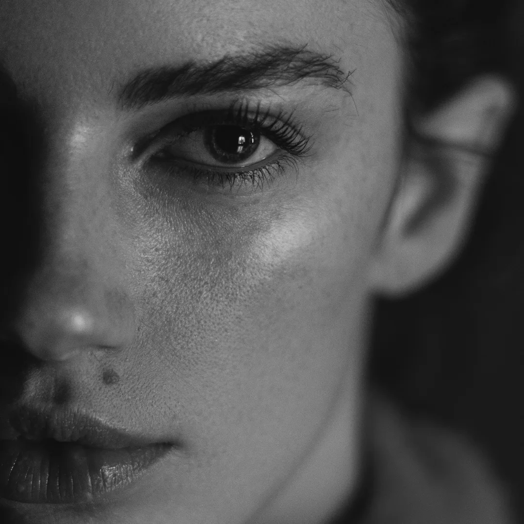 Recuperación de Cejas: Las cejas perfectas son posibles. En Haus Clinic, junto a Suelen Fonseca, te ofrecemos tratamientos de vanguardia para redefinir y mejorar tus cejas.